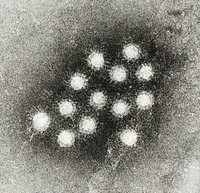 Hepatita acută virală tip A