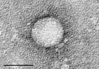 Hepatita virală tip C